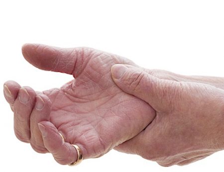 arthritis arthritis